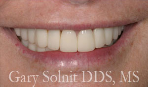 Beverly Hills Occlusal Disease Treatment & Adjustment